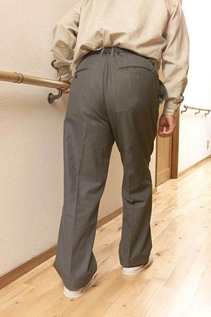 失われた歯の代わりはインプラントで