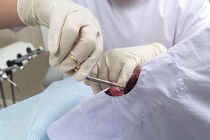 静岡のリモーネ矯正歯科では見えない矯正が行えます