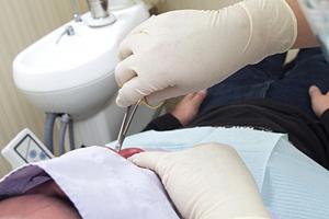 京都にある美容外科でリフトアップ